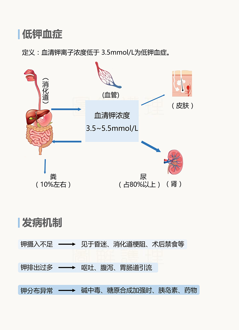 图说护理 | 低钾血症护理
